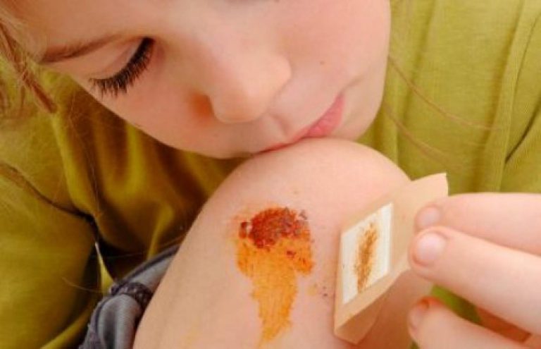 Jizva: správné ošetření a fáze hojení Jizva: správné ošetření a fáze hojení