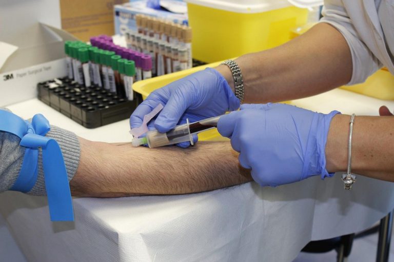 Hladina cholesterolu v krvi: může se zvýšit i díky vánočnímu přejídání