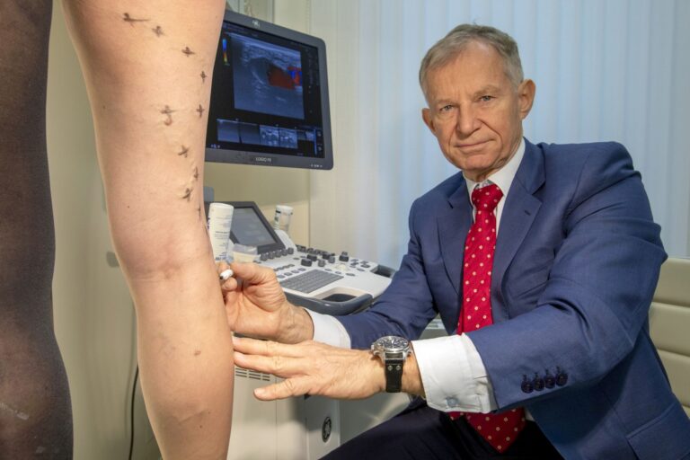 Příběh Anny: Jak operace křečových žil změnila můj pohled na vlastní tělo