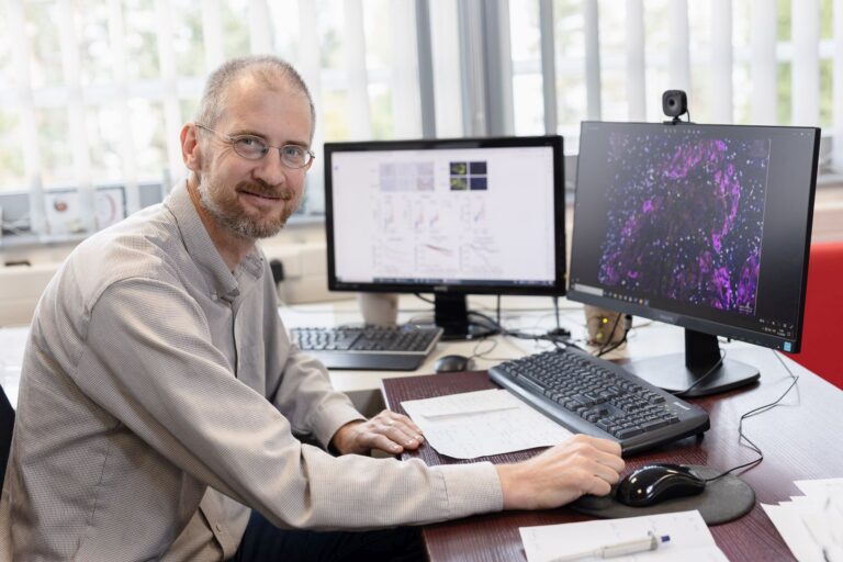 Rakovina prostaty: Olomoučtí vědci přinesli významný posun v léčbě rakoviny prostaty